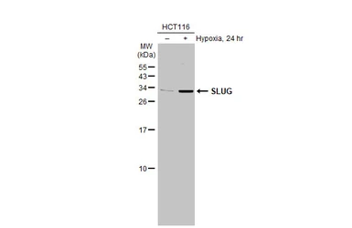 Anti-SLUG antibody used in Western Blot (WB). GTX128796