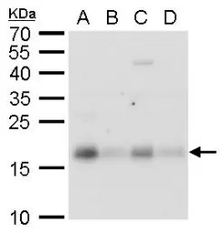 Anti-CHAC2 antibody used in Western Blot (WB). GTX128819