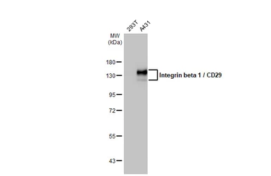 Anti-Integrin beta 1 / CD29 antibody used in Western Blot (WB). GTX128839