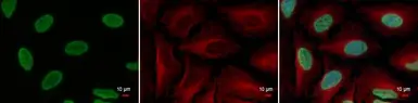 Anti-Histone H3K18ac (Acetyl Lys18) antibody used in Immunocytochemistry/ Immunofluorescence (ICC/IF). GTX128943