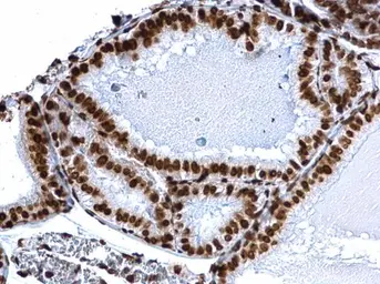 Anti-Histone H3K18ac (Acetyl Lys18) antibody used in IHC (Paraffin sections) (IHC-P). GTX128943