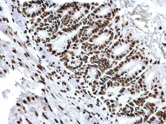 Anti-Histone H3K18ac (Acetyl Lys18) antibody used in IHC (Paraffin sections) (IHC-P). GTX128943