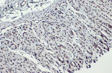Anti-Histone H3K18ac (Acetyl Lys18) antibody used in IHC (Paraffin sections) (IHC-P). GTX128943
