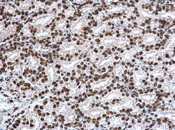 Anti-Histone H3K27ac (Acetyl Lys27) antibody used in IHC (Paraffin sections) (IHC-P). GTX128944