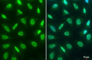 Anti-Histone H3K4me3 (Tri-methyl Lys4) antibody used in Immunocytochemistry/ Immunofluorescence (ICC/IF). GTX128954