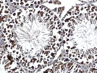 Anti-RUVBL2 antibody used in IHC (Paraffin sections) (IHC-P). GTX128970