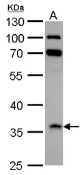 Anti-IGFBP2 antibody used in Western Blot (WB). GTX128977