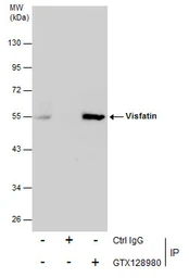 Anti-Visfatin antibody used in Immunoprecipitation (IP). GTX128980