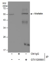 Anti-Visfatin antibody used in Immunoprecipitation (IP). GTX128980