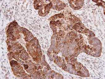 Anti-L1CAM antibody used in IHC (Paraffin sections) (IHC-P). GTX129010