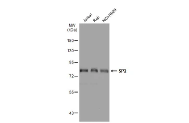 Anti-SP2 antibody used in Western Blot (WB). GTX129030