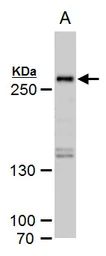 Anti-SETD1A antibody used in Western Blot (WB). GTX129035