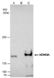 Anti-KDM3A antibody used in Immunoprecipitation (IP). GTX129046