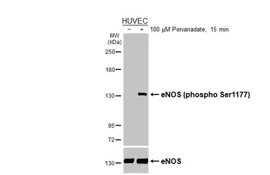 Anti-eNOS (phospho Ser1177) antibody used in Western Blot (WB). GTX129058