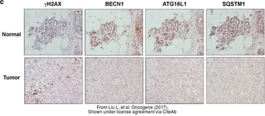 Anti-FIP200 antibody used in IHC (Paraffin sections) (IHC-P). GTX129093
