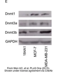Anti-DNMT3A antibody used in Western Blot (WB). GTX129125