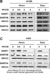 Anti-DNMT3A antibody used in Western Blot (WB). GTX129125