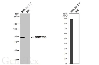 Anti-DNMT3B antibody used in Western Blot (WB). GTX129127