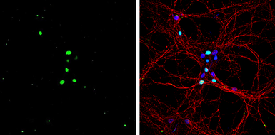 Anti-PROX1 antibody used in Immunocytochemistry/ Immunofluorescence (ICC/IF). GTX129143
