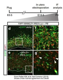 Anti-YAP1 antibody used in IHC (Frozen sections) (IHC-Fr). GTX129151
