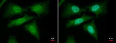 Anti-YAP1 antibody used in Immunocytochemistry/ Immunofluorescence (ICC/IF). GTX129151