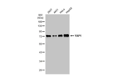 Anti-YAP1 antibody used in Western Blot (WB). GTX129151