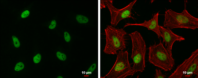 Anti-G9a antibody used in Immunocytochemistry/ Immunofluorescence (ICC/IF). GTX129153