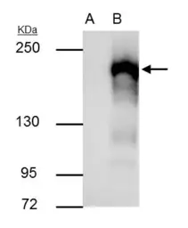Anti-G9a antibody used in Immunoprecipitation (IP). GTX129153