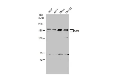 Anti-G9a antibody used in Western Blot (WB). GTX129153