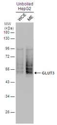 Anti-GLUT3 antibody used in Western Blot (WB). GTX129175