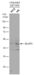Anti-GLUT3 antibody used in Western Blot (WB). GTX129175