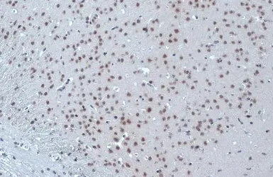 Anti-ER81 antibody used in IHC (Paraffin sections) (IHC-P). GTX129202