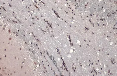 Anti-ER81 antibody used in IHC (Paraffin sections) (IHC-P). GTX129202