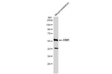Anti-ER81 antibody used in Western Blot (WB). GTX129202
