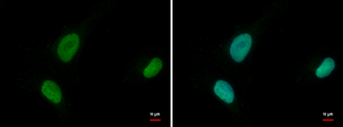 Anti-MCM6 antibody used in Immunocytochemistry/ Immunofluorescence (ICC/IF). GTX129216