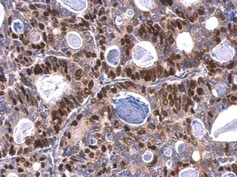 Anti-MCM6 antibody used in IHC (Paraffin sections) (IHC-P). GTX129216