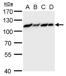 Anti-MCM6 antibody used in Western Blot (WB). GTX129216