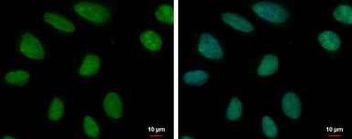 Anti-MCM6 antibody used in Immunocytochemistry/ Immunofluorescence (ICC/IF). GTX129218