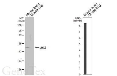 Anti-LHX2 antibody used in Western Blot (WB). GTX129241