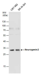Anti-Neurogenin 2 antibody used in Western Blot (WB). GTX129258