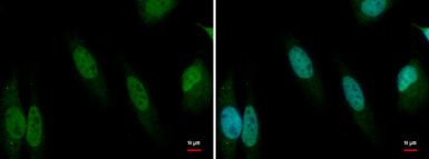 Anti-CITED2 antibody used in Immunocytochemistry/ Immunofluorescence (ICC/IF). GTX129265