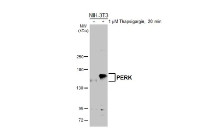 Anti-PERK antibody used in Western Blot (WB). GTX129275