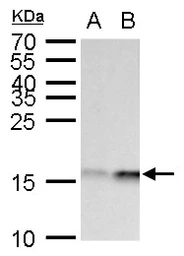 Anti-GABARAPL1 antibody used in Western Blot (WB). GTX129277