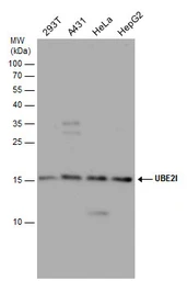 Anti-UBE2I antibody used in Western Blot (WB). GTX129293