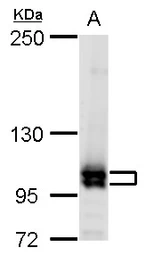Anti-Cullin 4b antibody used in Western Blot (WB). GTX129298