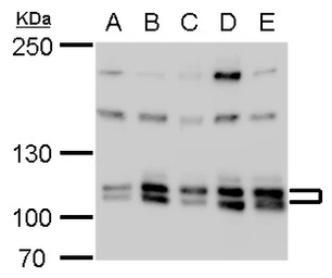 Anti-Cullin 4b antibody used in Western Blot (WB). GTX129298