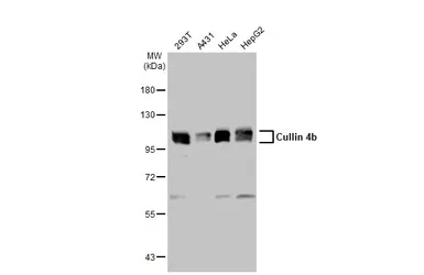 Anti-Cullin 4b antibody used in Western Blot (WB). GTX129298