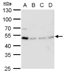 Anti-TIPIN antibody used in Western Blot (WB). GTX129308