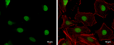 Anti-Claspin antibody used in Immunocytochemistry/ Immunofluorescence (ICC/IF). GTX129311