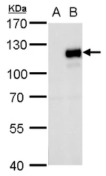 Anti-MKL1 antibody used in Western Blot (WB). GTX129371